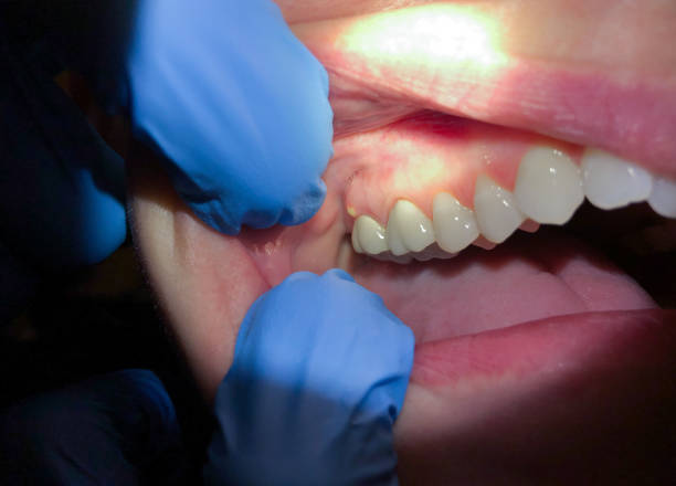 Best Emergency Denture Repair in North Chicago, IL