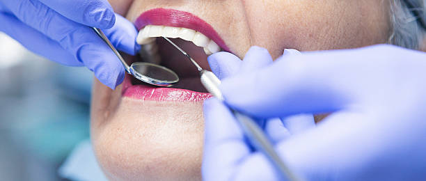 Best Emergency Dental Care for Broken or Chipped Teeth in North Chicago, IL